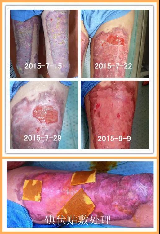 944a782d9102f644ee24d1fe71ac8ac2.jpg 944a782d9102f644ee24d1fe71ac8ac2.jpg