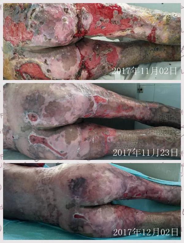 df72a831ed5e56164bb20aab9fcbc7ec.jpg df72a831ed5e56164bb20aab9fcbc7ec.jpg