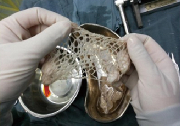 7c1b52eb42ae3cb10d2f69bf843f1862.jpg 7c1b52eb42ae3cb10d2f69bf843f1862.jpg